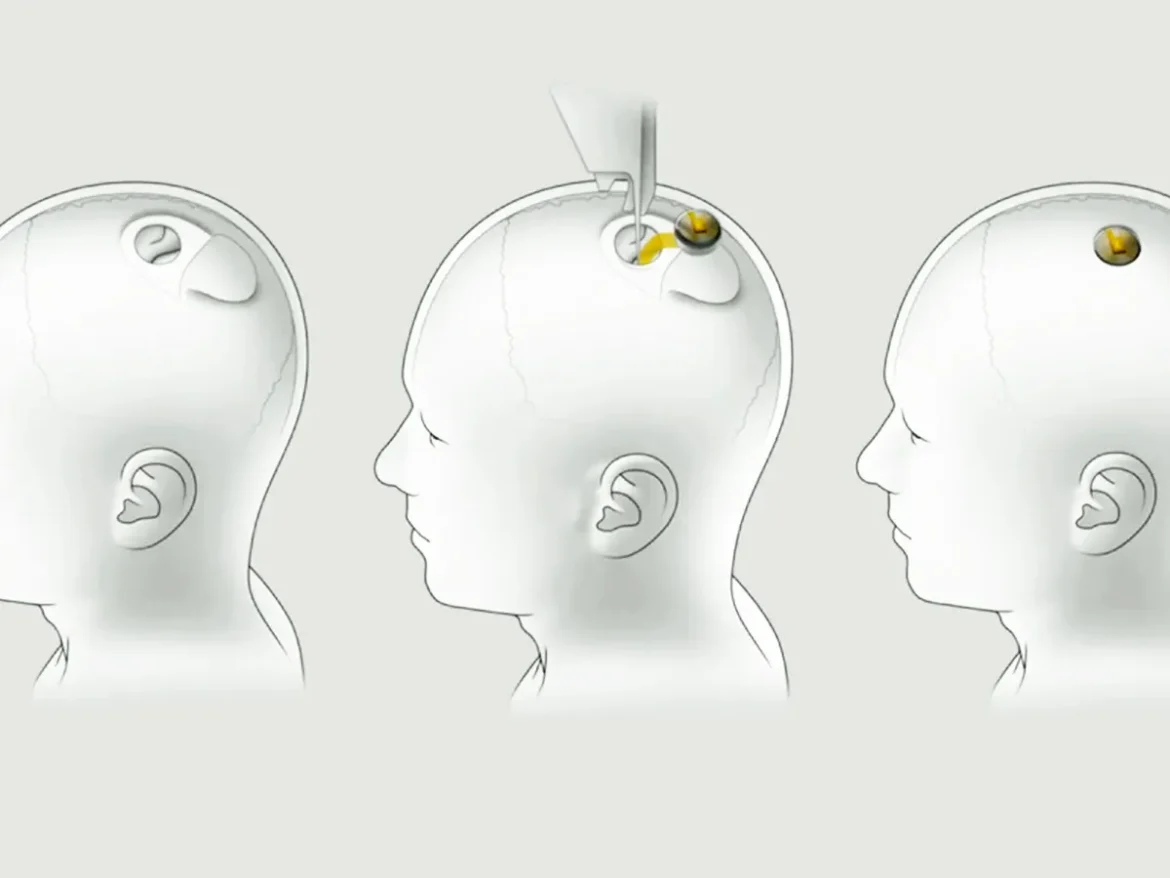 neuralink